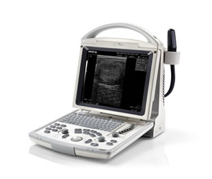 Портативный УЗИ сканер Mindray DP-10 - Фото 1