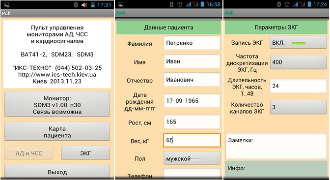 Монітор артеріального тиску та електрокардіосигналів добовий SDM 23 - Фото 1