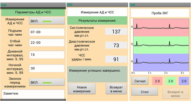 Монітор артеріального тиску та електрокардіосигналів добовий SDM 23 - Фото 1