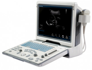Портатиный УЗИ сканер Mindray DP-50 - Фото 1