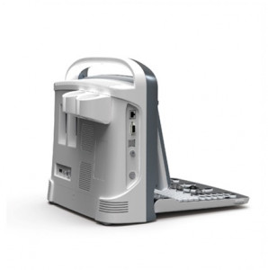 Портативный черно-белый УЗ сканер Chison ECO1 - Фото 1