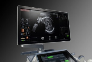 Стационарный УЗИ аппарат VOLUSON E8 - Фото 1