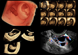 Стационарный УЗИ аппарат VOLUSON E8 - Фото 1