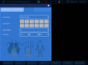 Электрокардиограф 6-канальный iMAC 12 - Фото 1