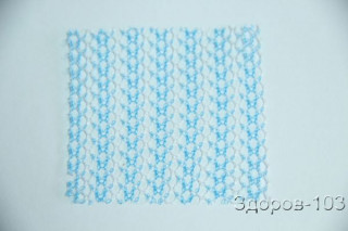 Сетка полипропиленовая медицинская стерильная «Омега-2 ДП» (20см х10см) - Фото 1