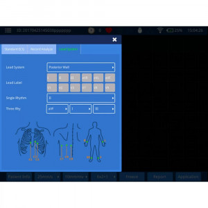 Электрокардиограф 6-канальный iMAC 12 - Фото 1