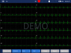 Електрокардіограф 12-канальний iMAC 120 - Фото 1